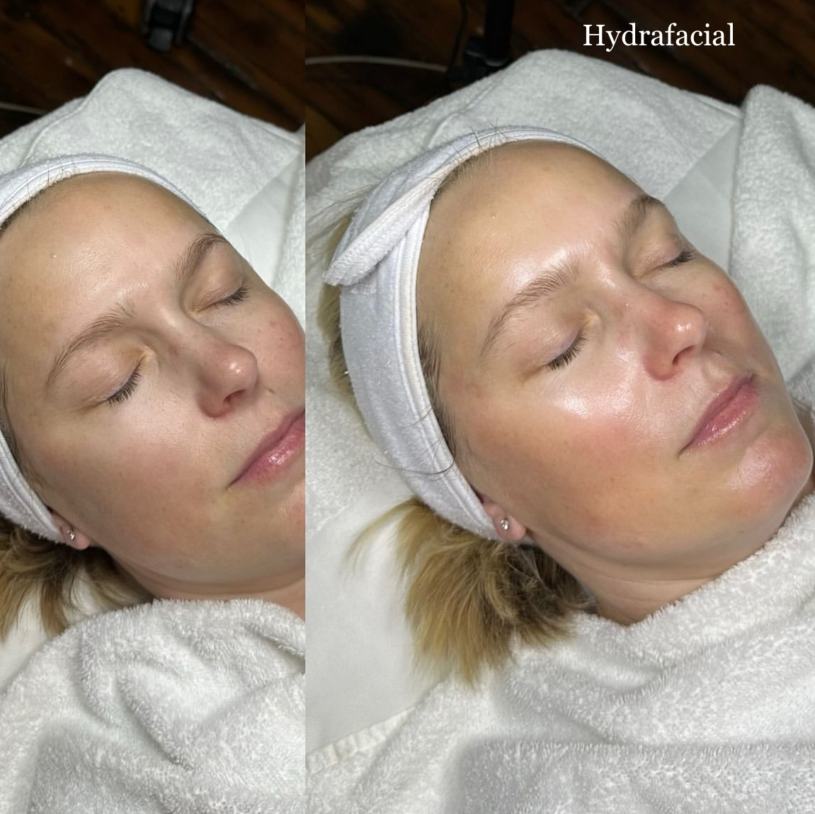 Brows & Skin Before & After